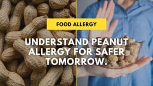 All you need to know about peanut allergies in fresno and merced