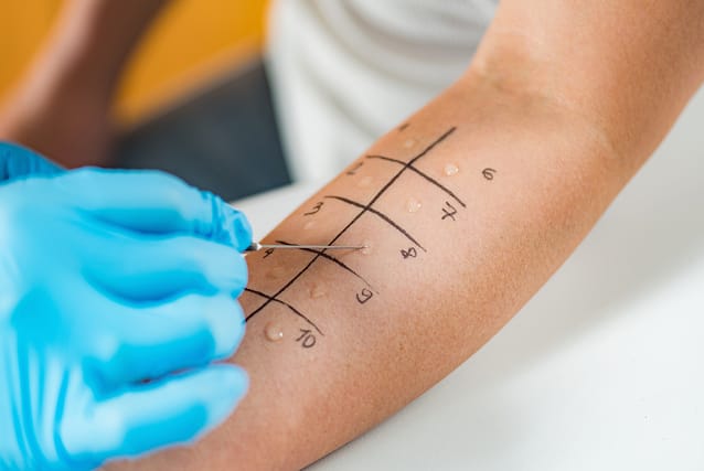 Spring allergy diagnosis and testing services